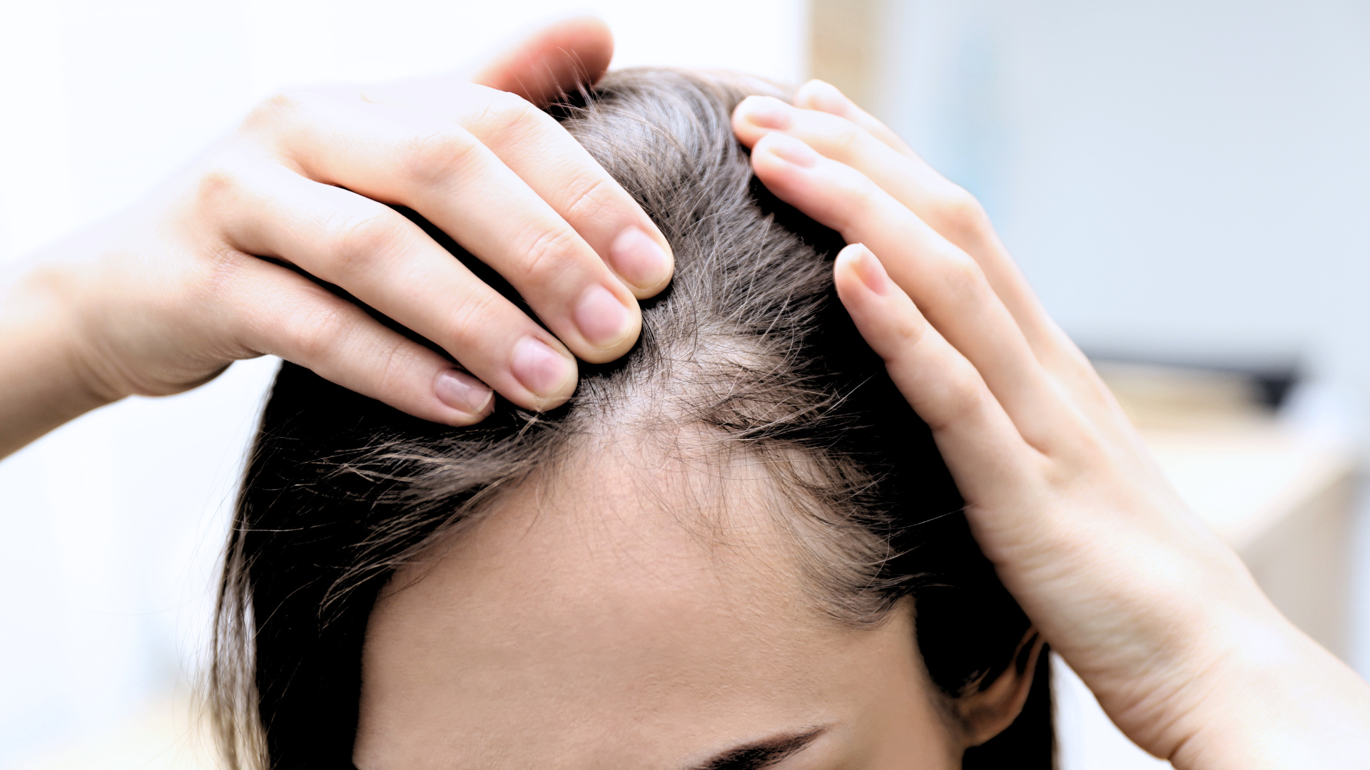 pattern baldness